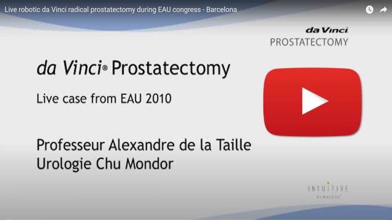Démonstration chirurgicale d'une prostatectomie radicale robotique pendant el congrès de l'EAU à Barcelona